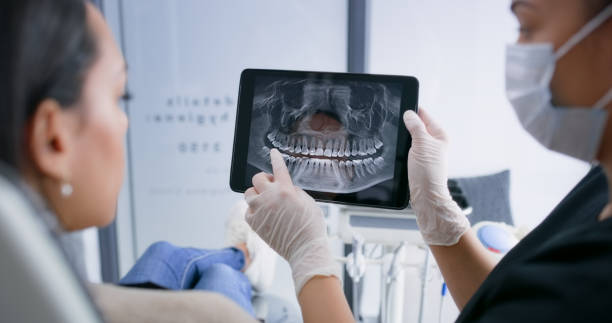 Licensed Tooth Extraction service in East Lansing, MI - Smile Center Dentistry